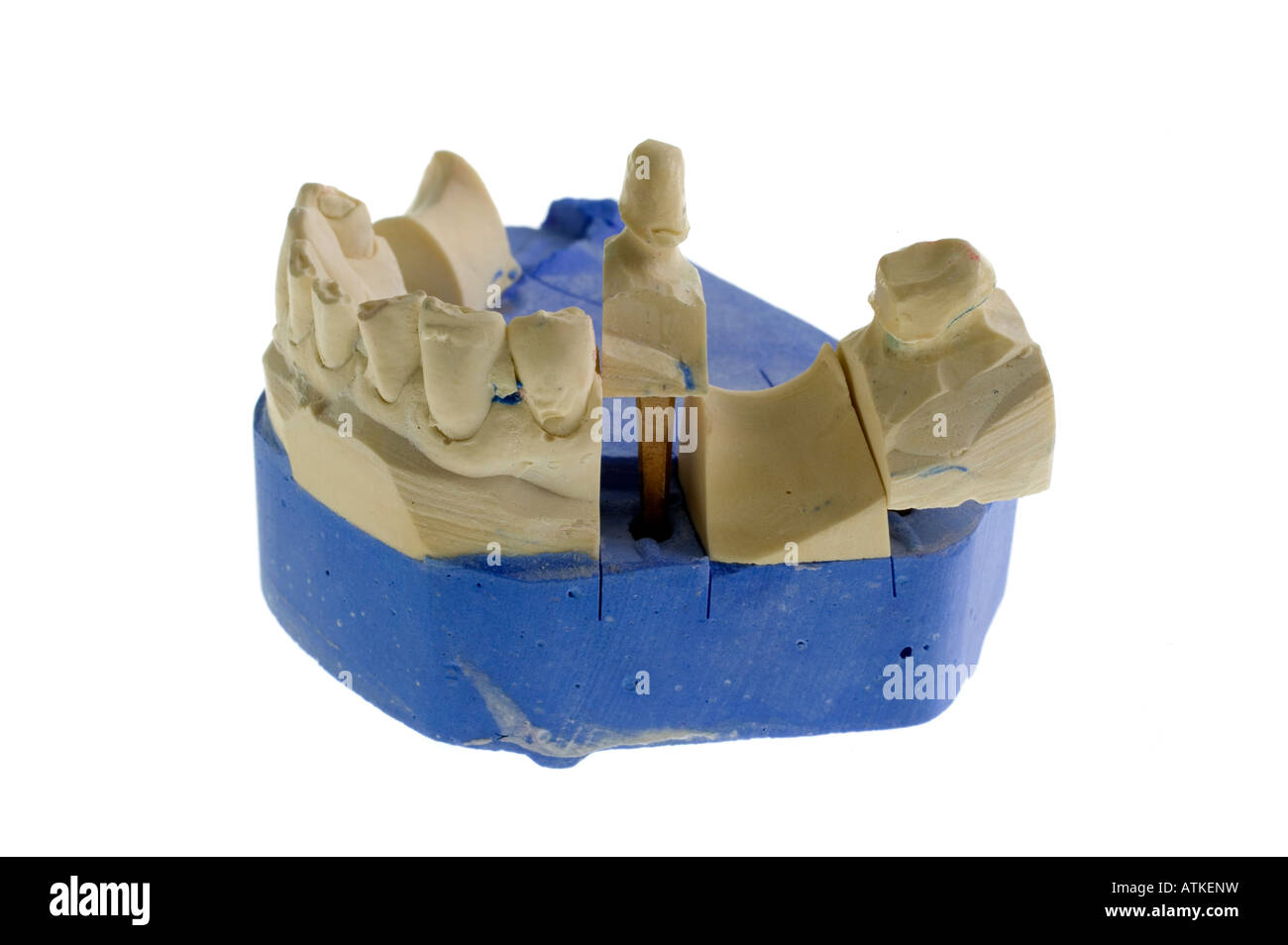 Modell für Zahnersatz, dental prostheses Stock Photo