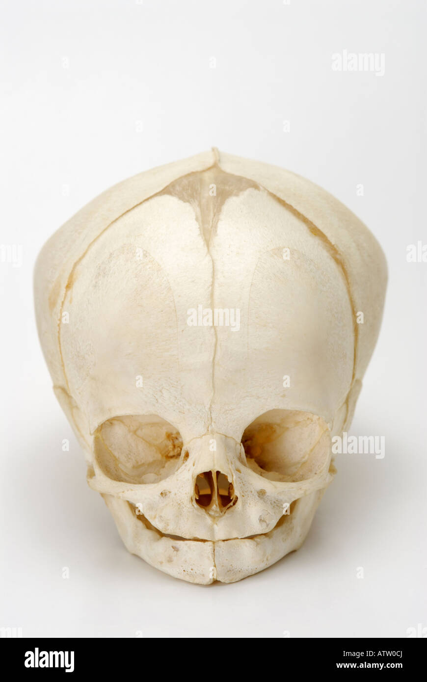 Skull from a full term human fetus foetus Stock Photo