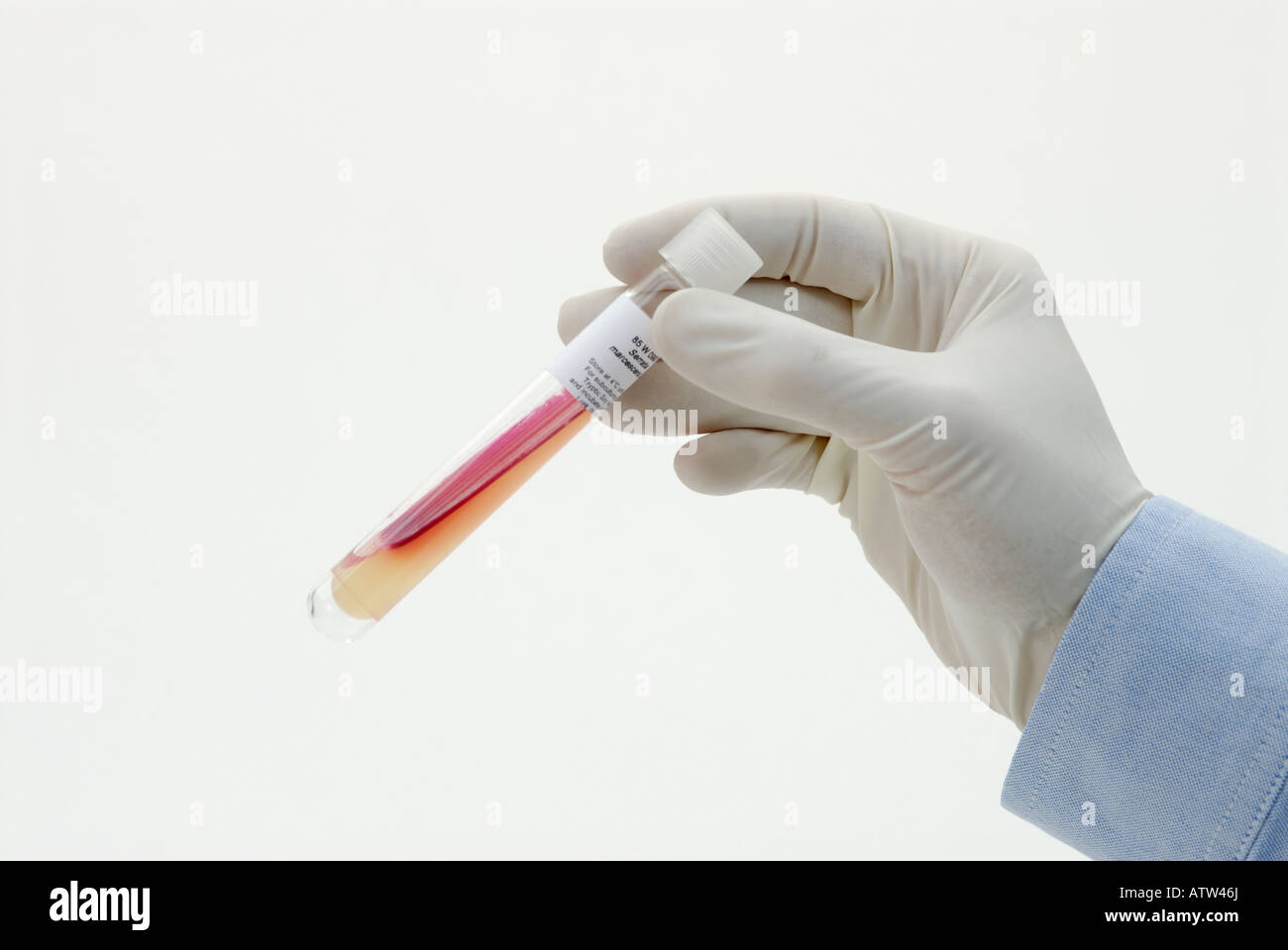 A scientist holds a tube containing a starter culture of Serratia marcescens on agar for research use Stock Photo