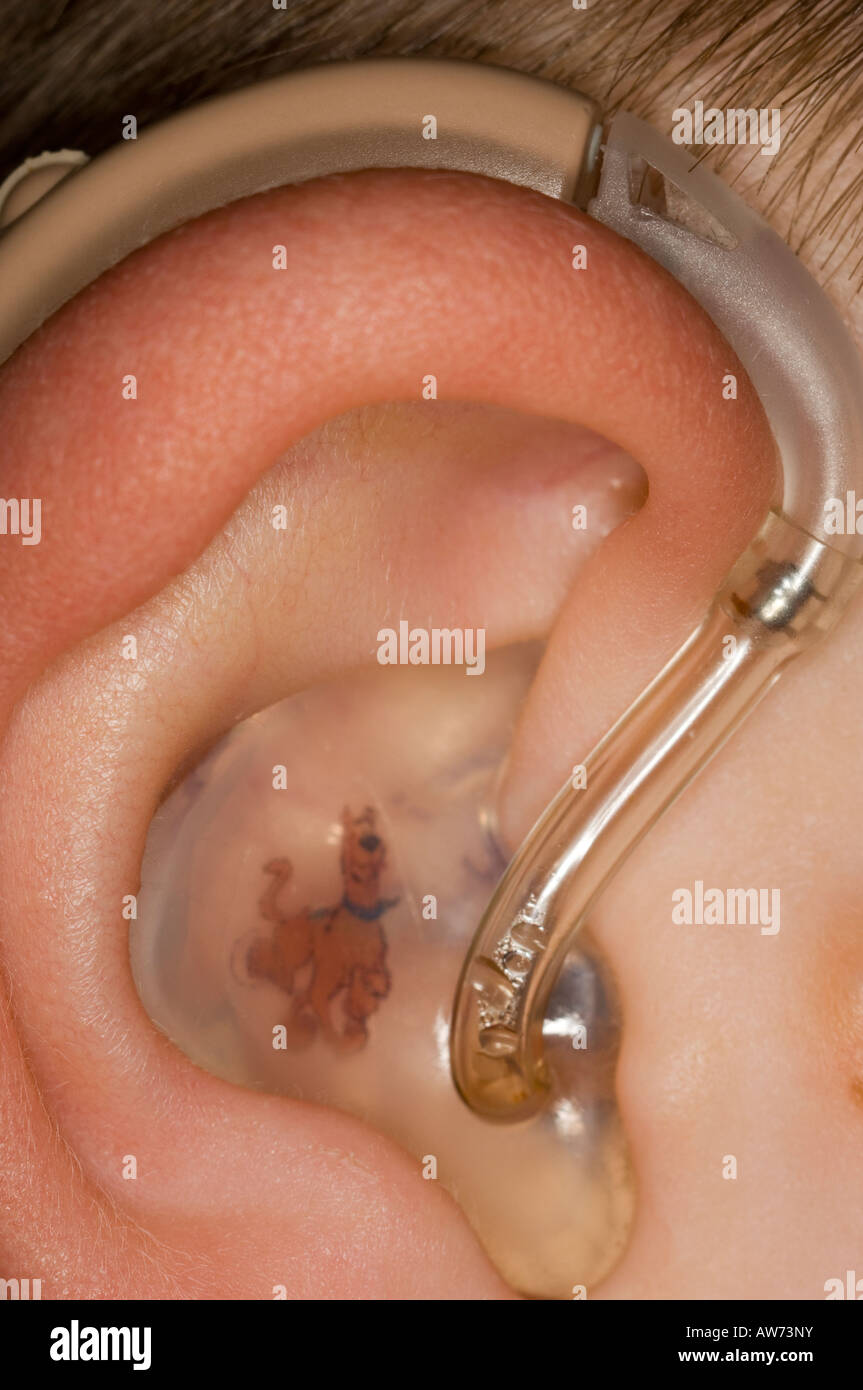 A deaf Child Wearing Hearing Aid Stock Photo Alamy