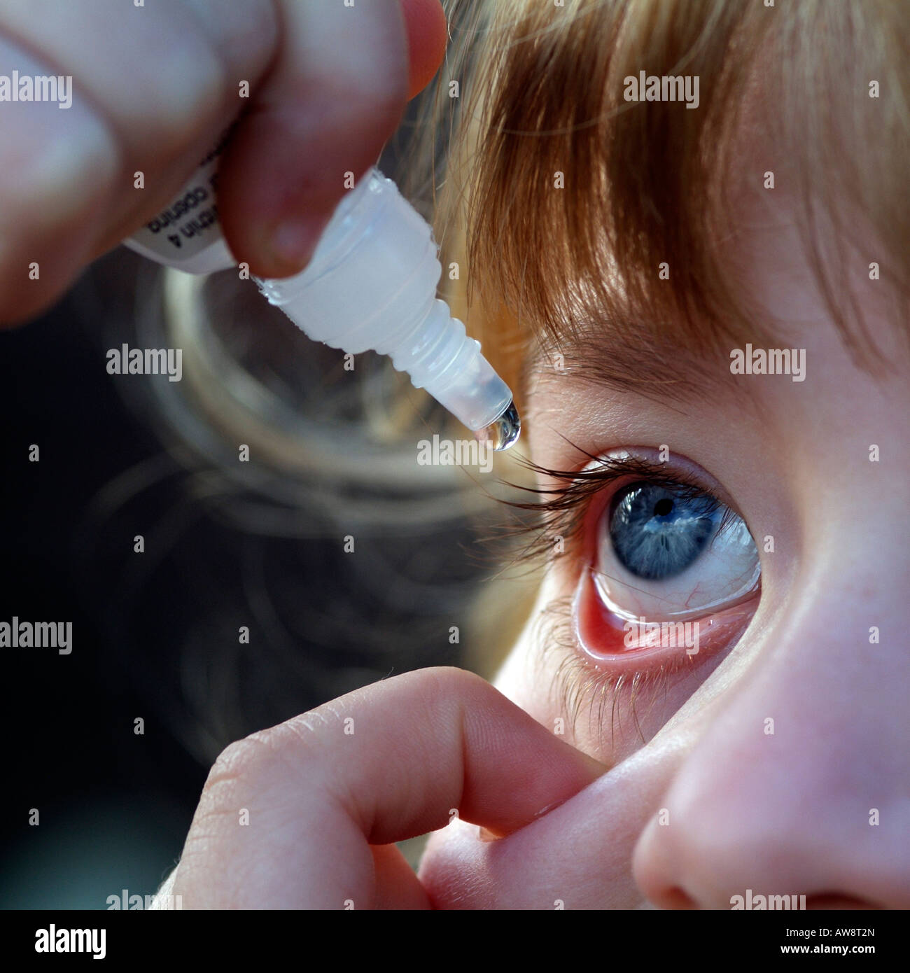 Child Applying Eye Drops Stock Photo Alamy