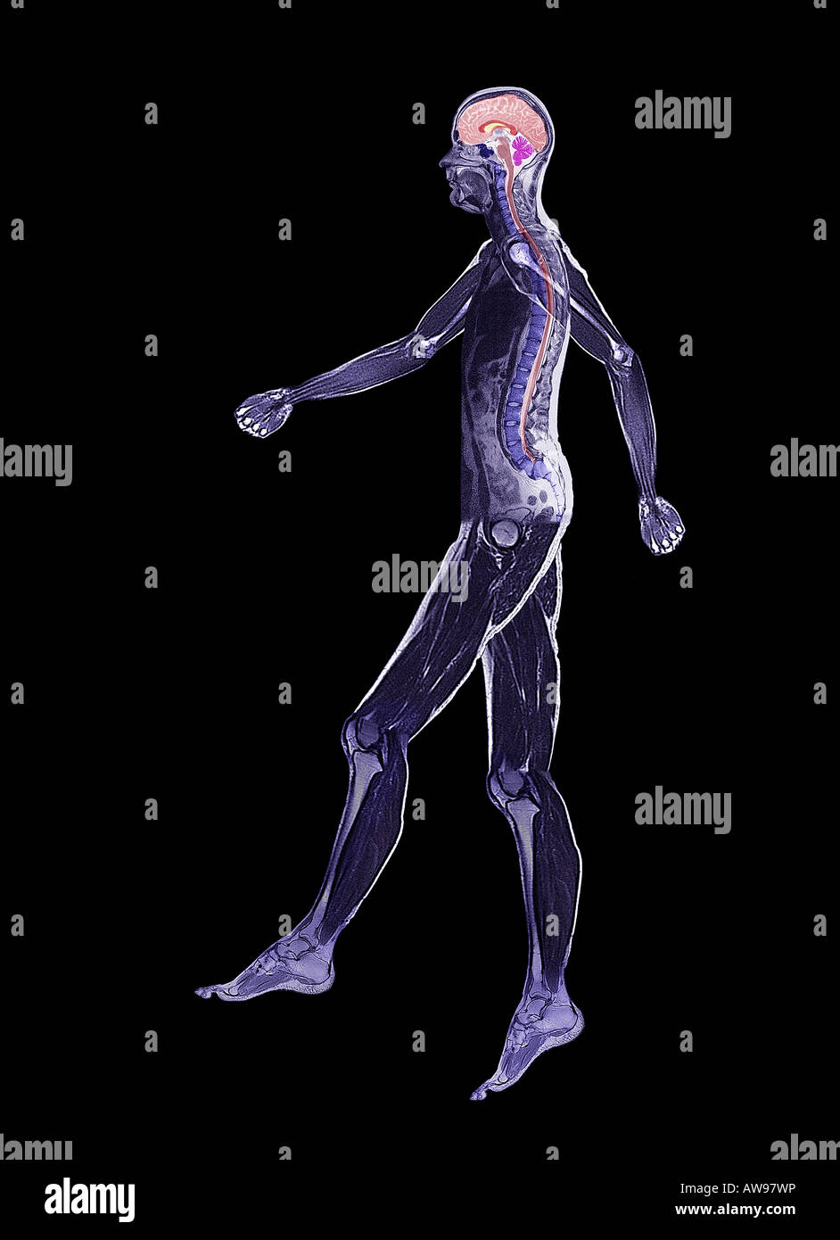 magnetic resonance image of mans whole body walking Stock Photo
