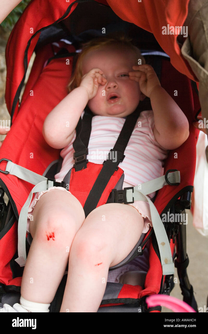 Female toddler with grazed knees crying in pushchair Stock Photo