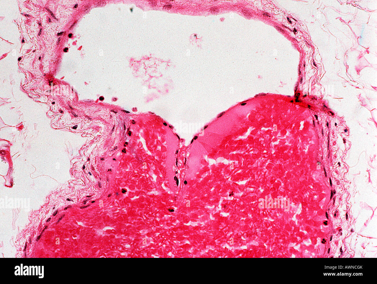 Vein Stock Photo