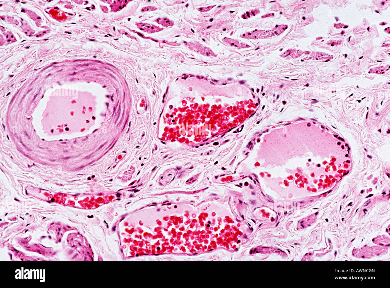 Blood Vessels Under A Microscope at Bryan Robin blog