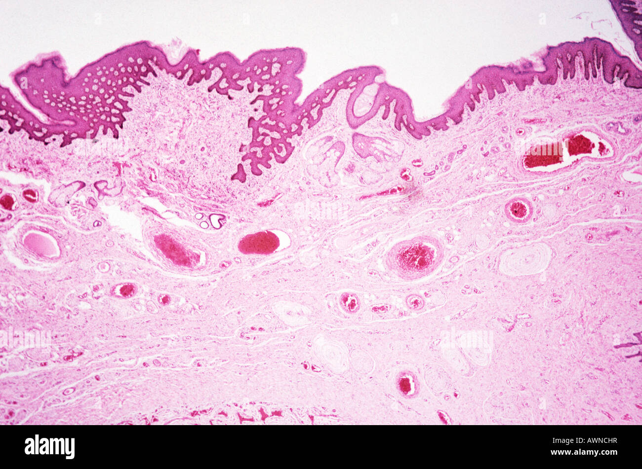 Labium minus Stock Photo: 16621906 - Alamy