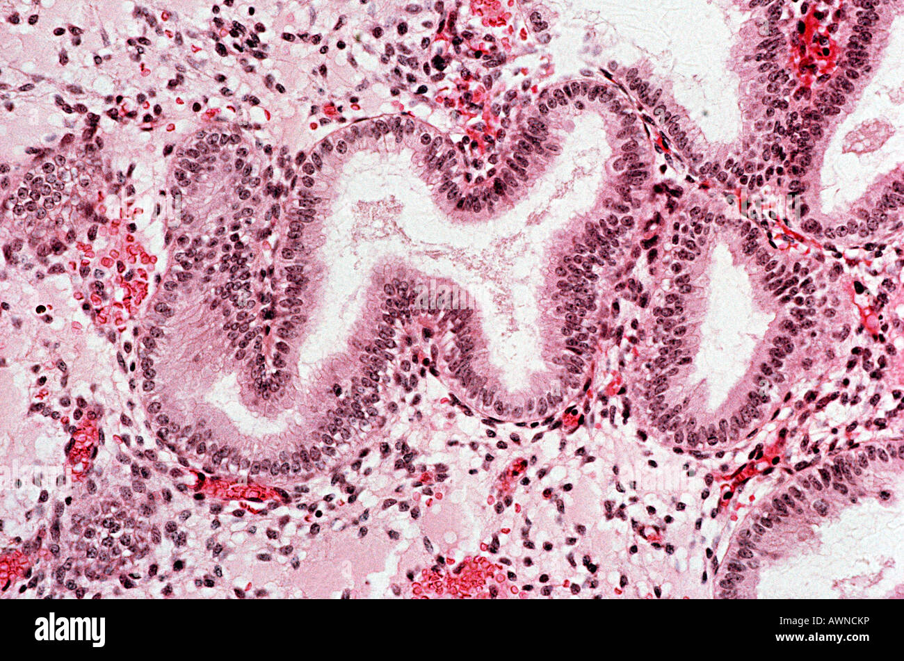 Endometrium Stock Photo: 16621929 - Alamy