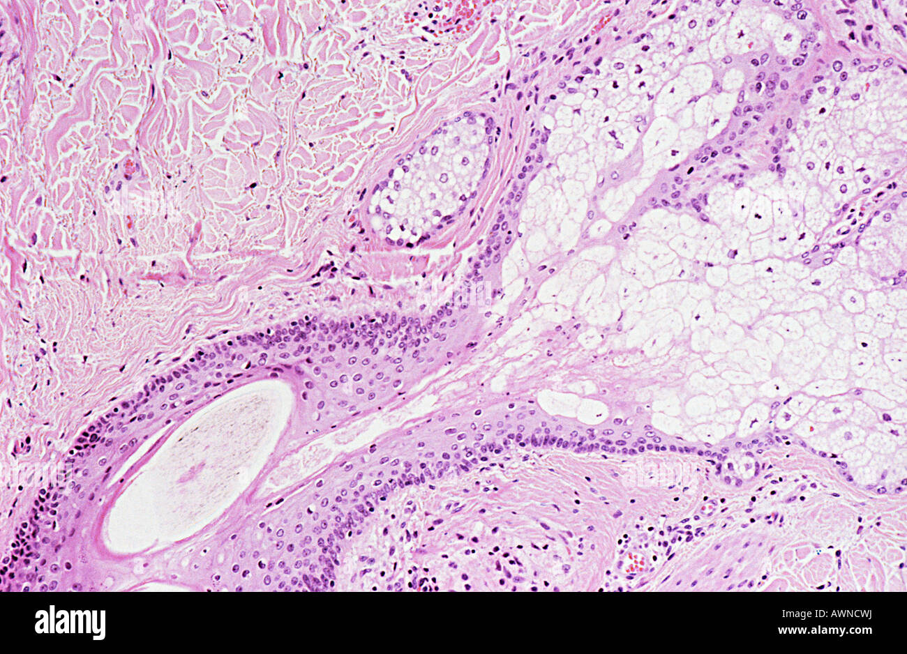 Skin Cell Under Microscope