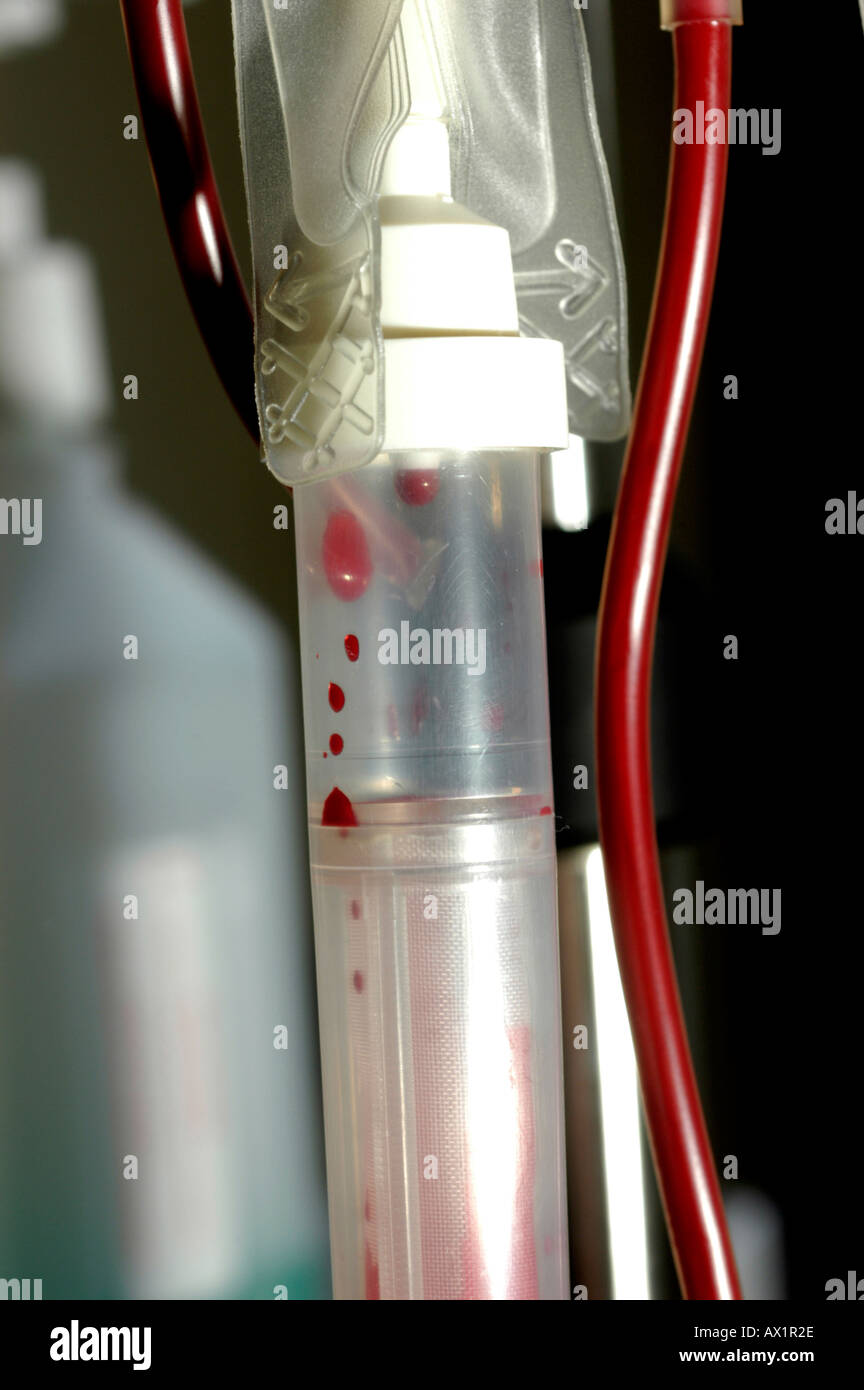Intravenous drip chamber Stock Photo Alamy