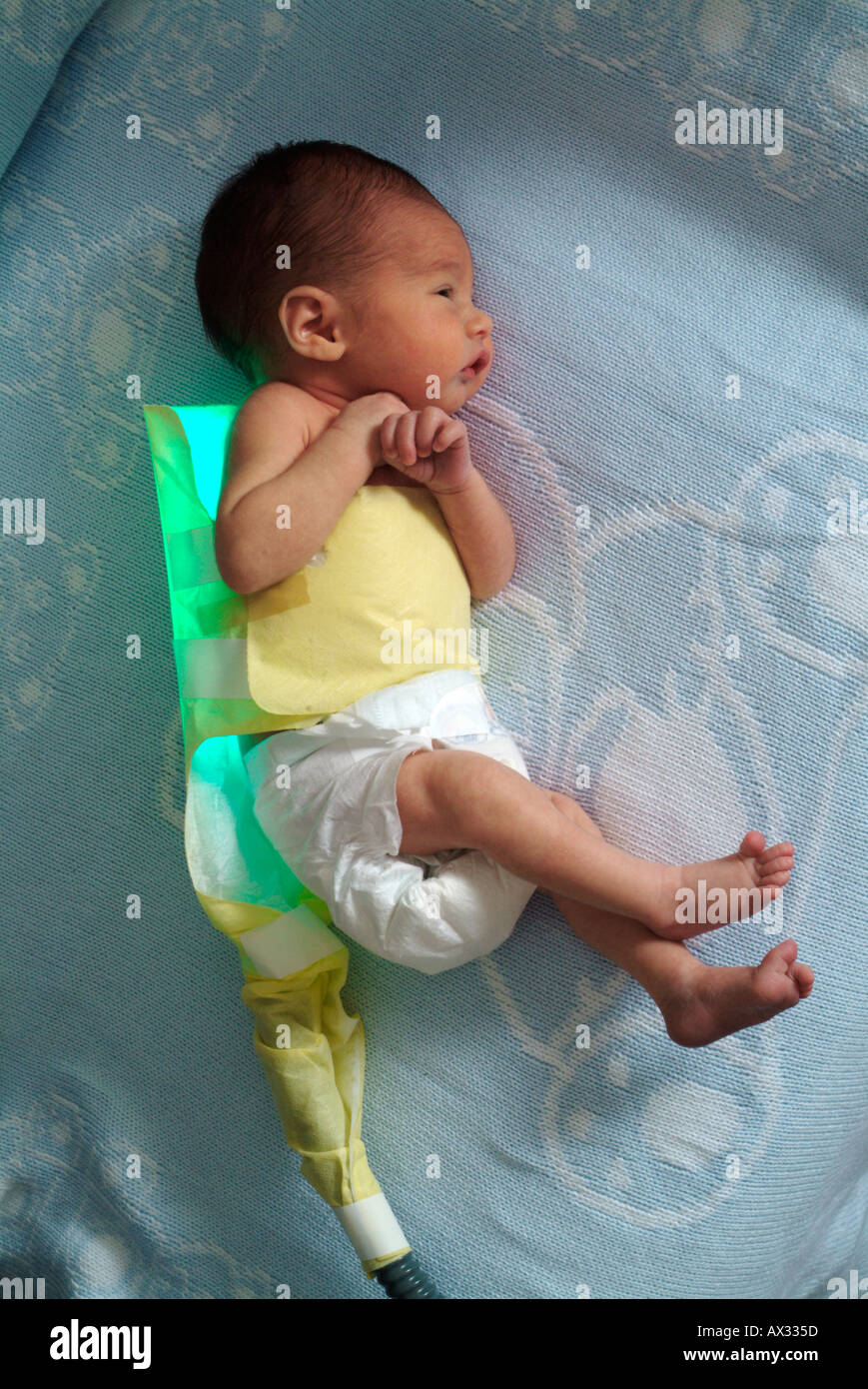 Fiber Optic Pad on Newborn Stock Photo Alamy