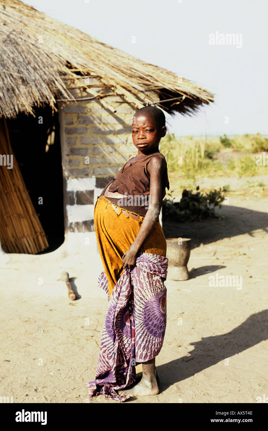 Lusaka, Zambia. Very pregnant young African woman in ragged clothes outside her poor house on the outskirts of the city. Stock Photo