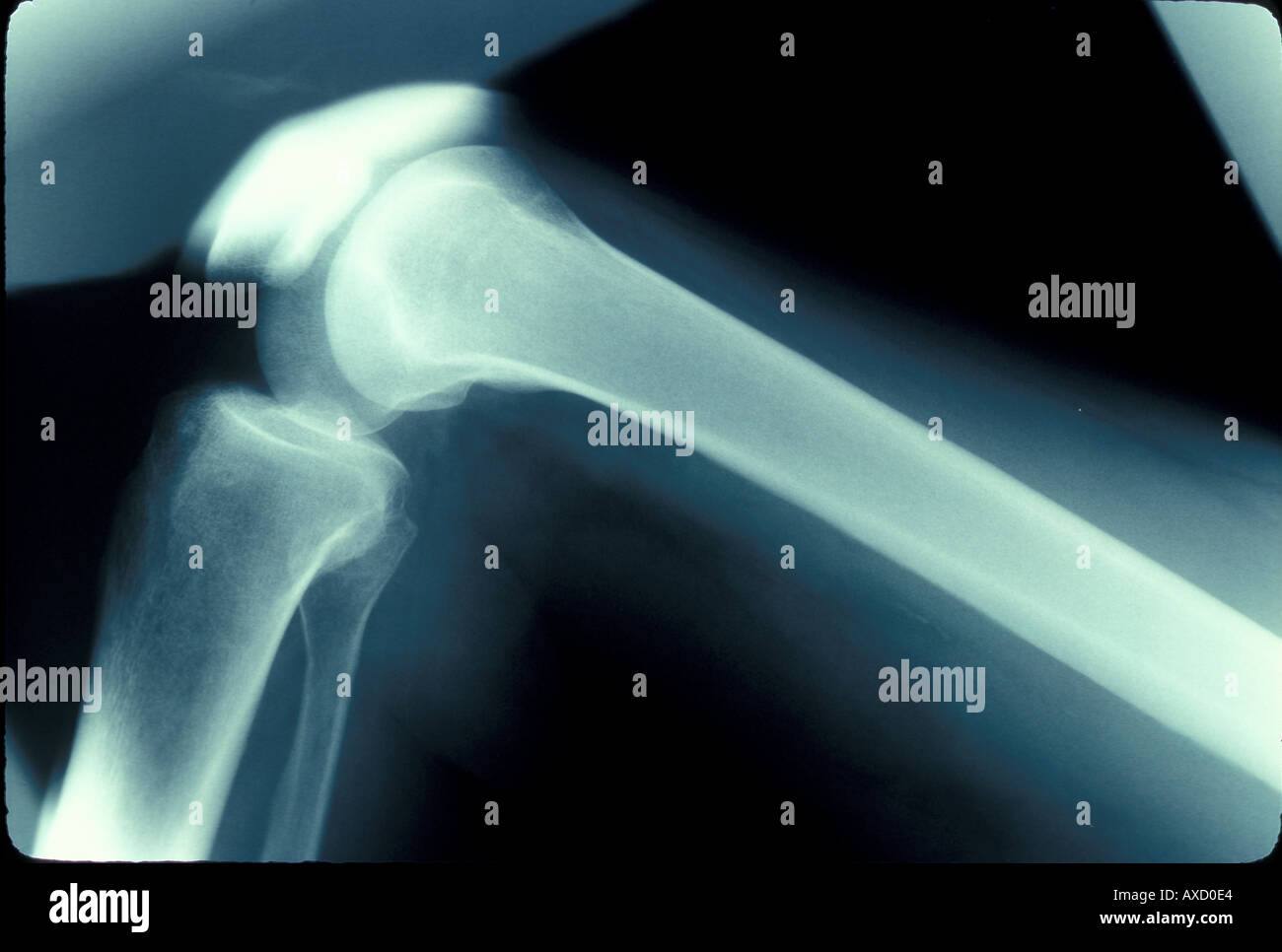 Science Medical X ray of knee joint Stock Photo - Alamy