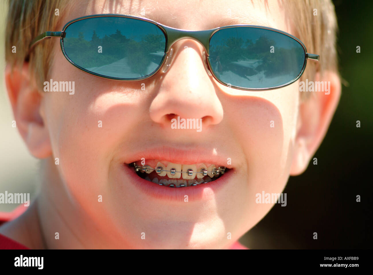 A young boy with sunglasses and braces close up Stock Photo Alamy