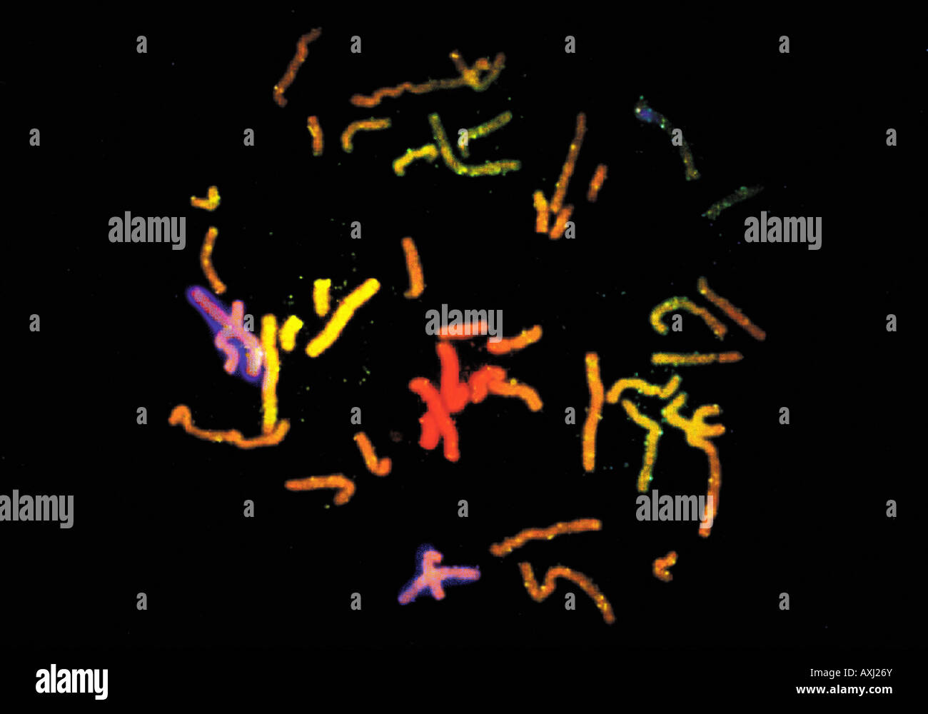 human chromosomes XY Stock Photo