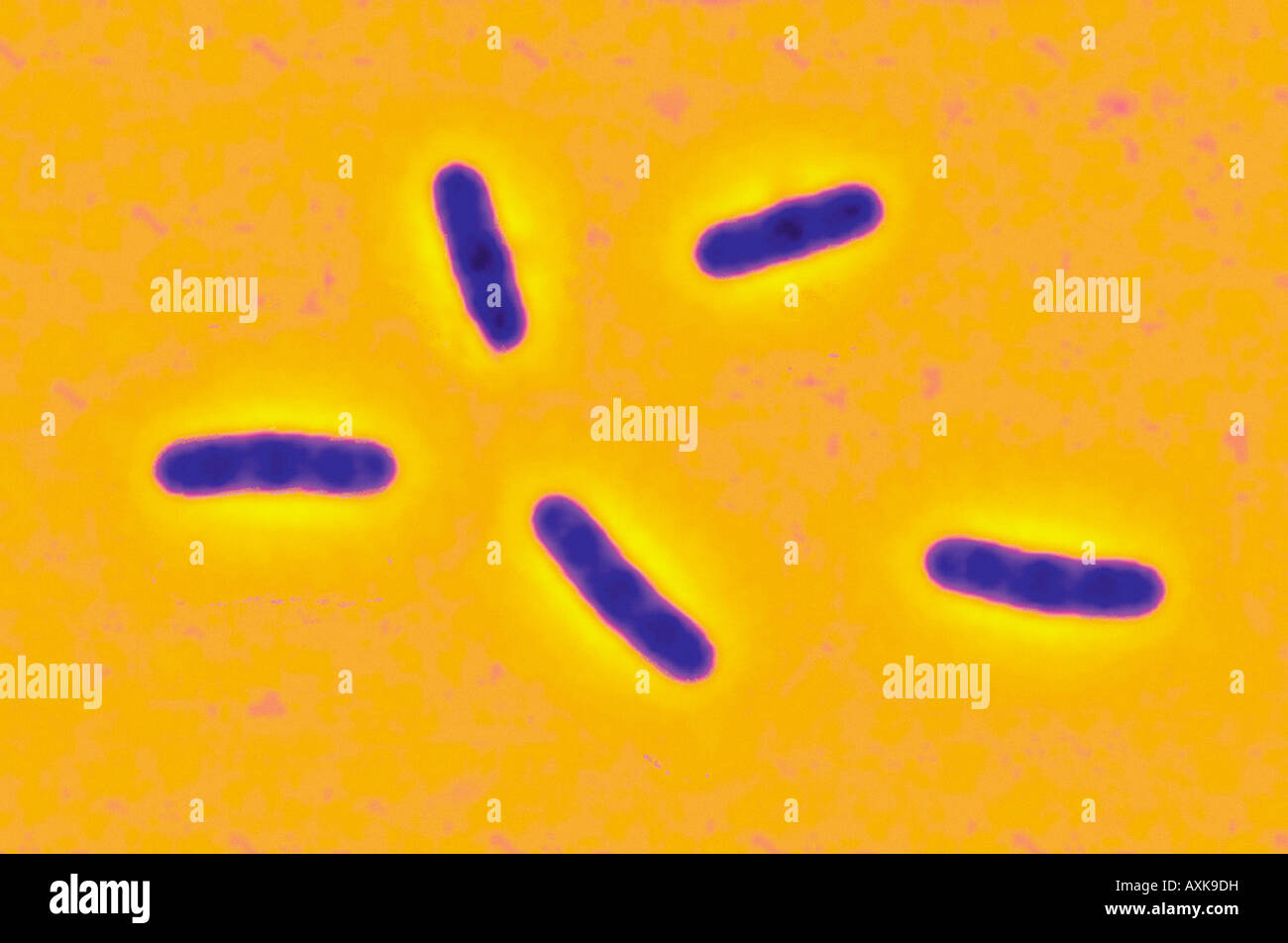 E coli bacteria Stock Photo