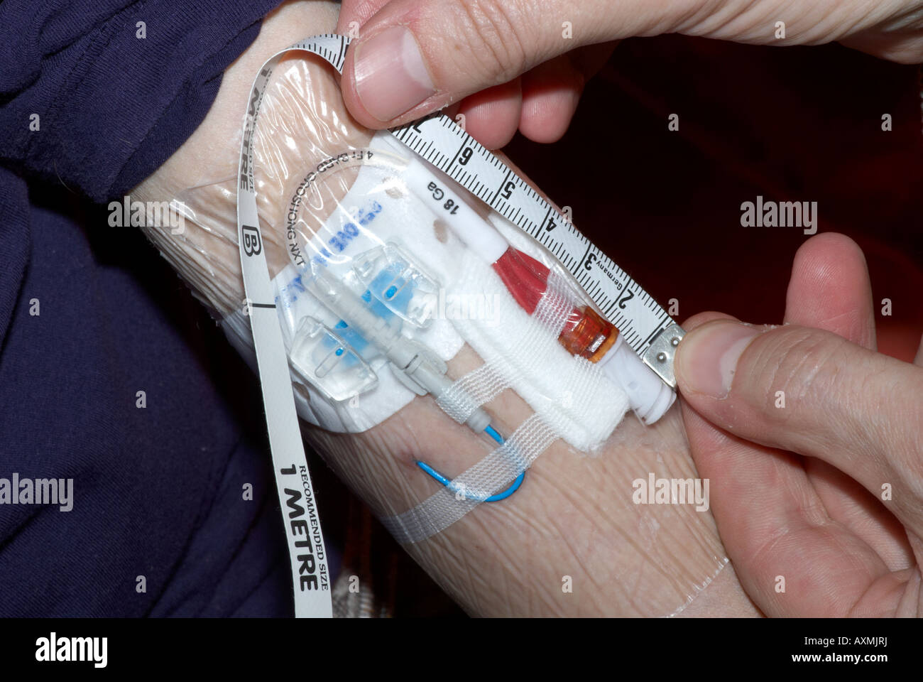 Measuring a Picc line after cleaning - peripherally inserted central catheter Stock Photo