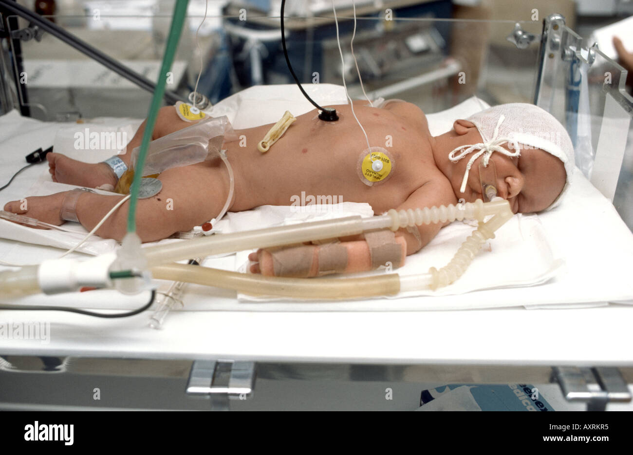 baby in incubator on a ventilator machine Stock Photo - Alamy