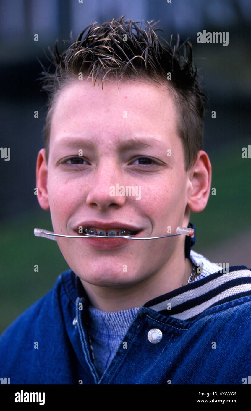 Headgear braces hires stock photography and images Alamy