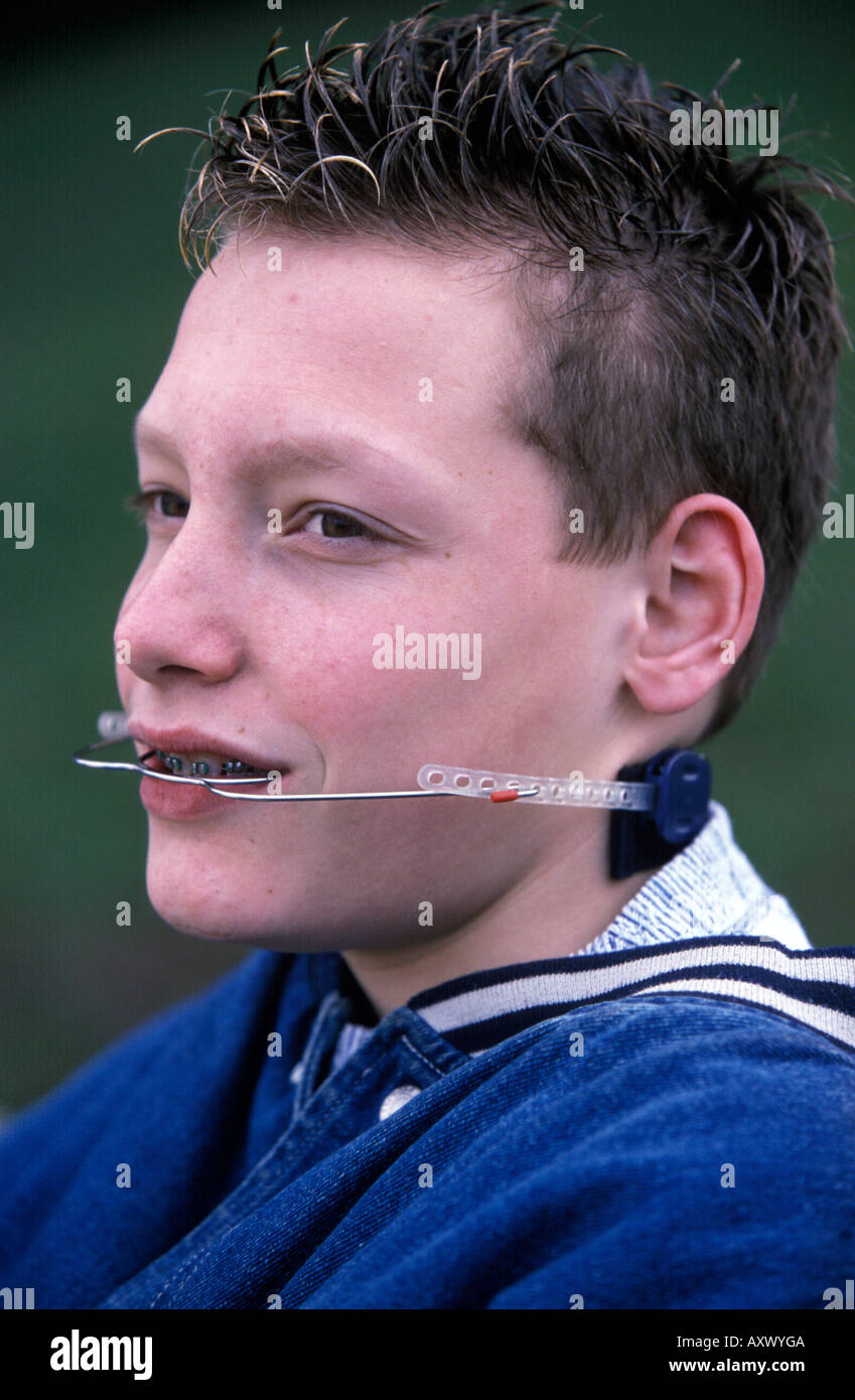 Headgear braces hires stock photography and images Alamy