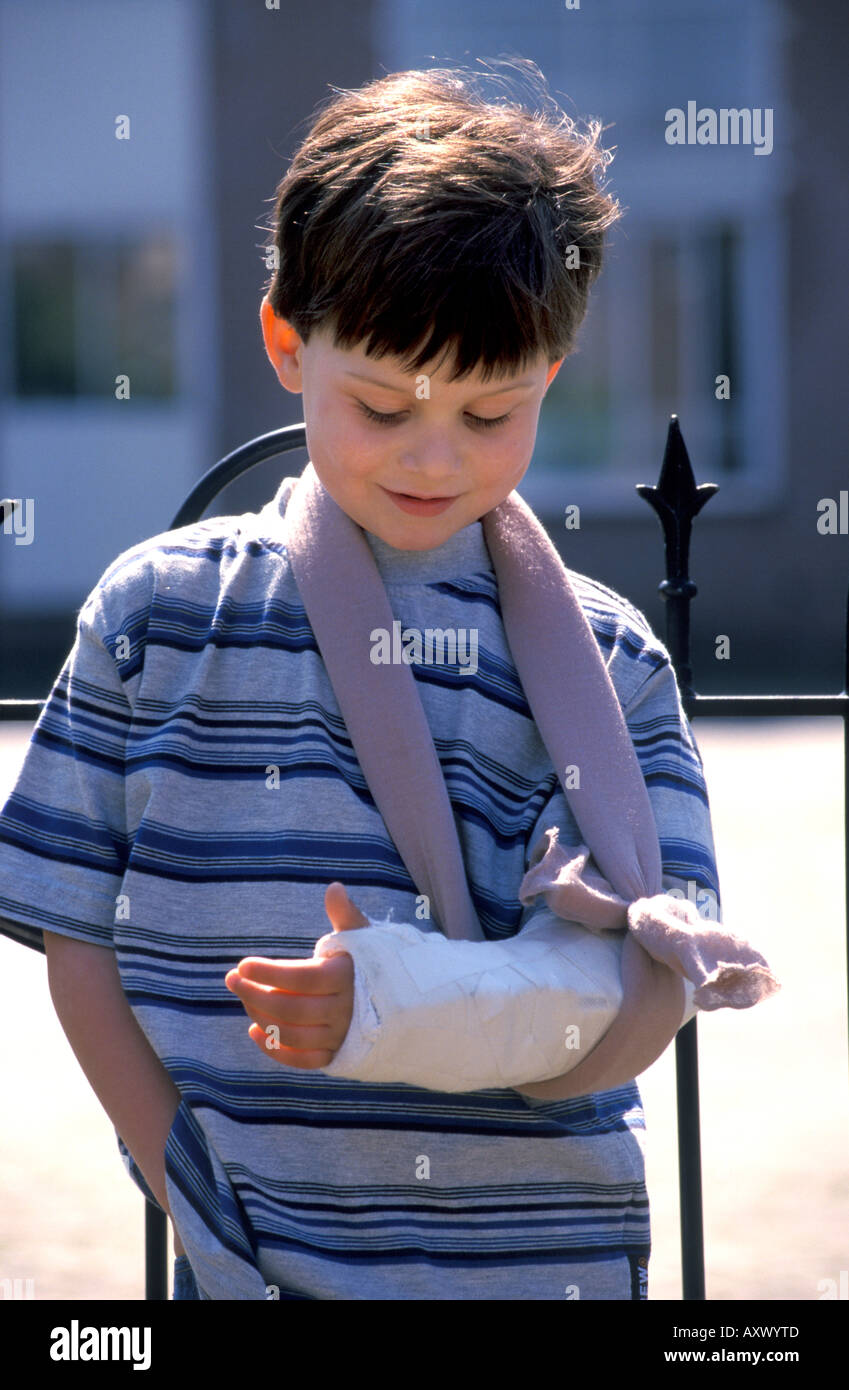 Boy with a broken arm Stock Photo Alamy