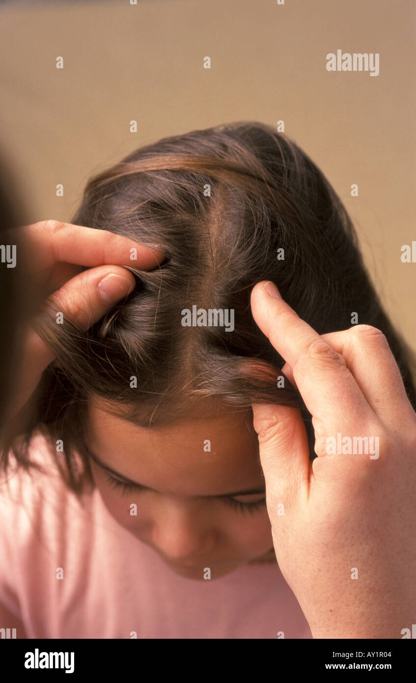 Eight Year Old Girl Is Checked For Lice In Her Hair Stock Photo