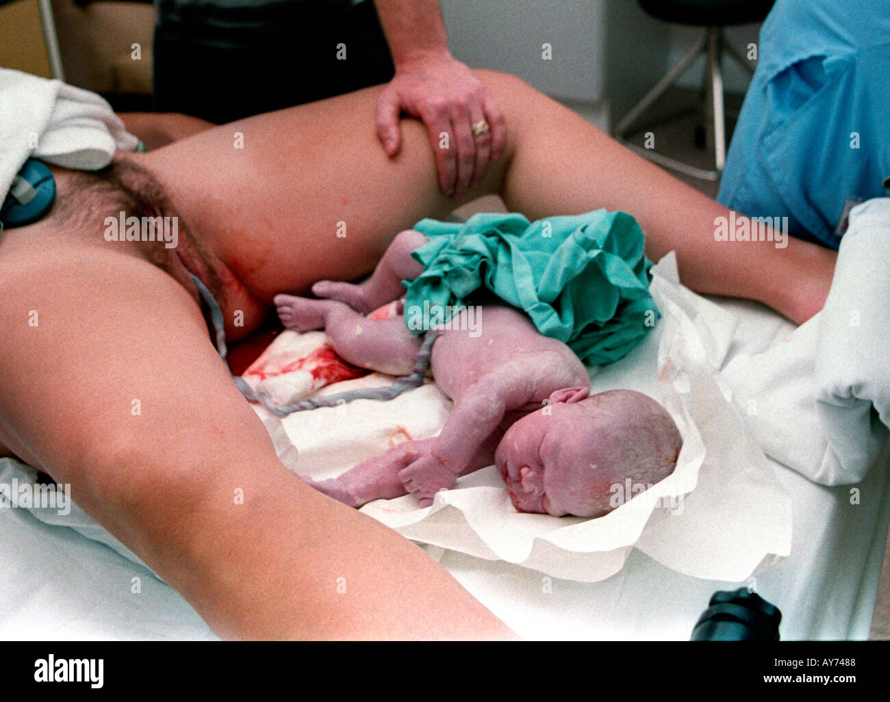 placenta birth