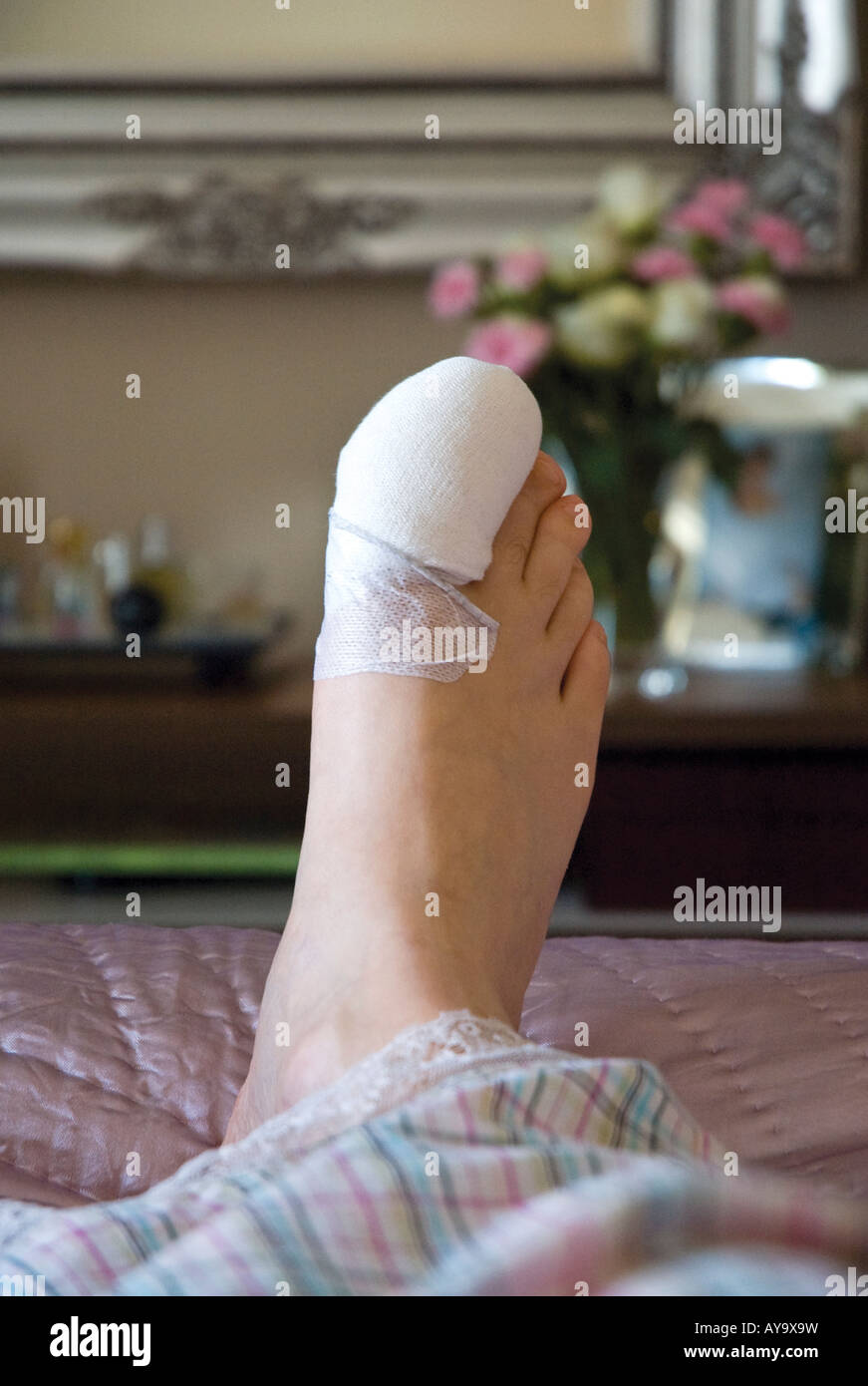 Bandaged Foot Stock Photos & Bandaged Foot Stock Images Alamy