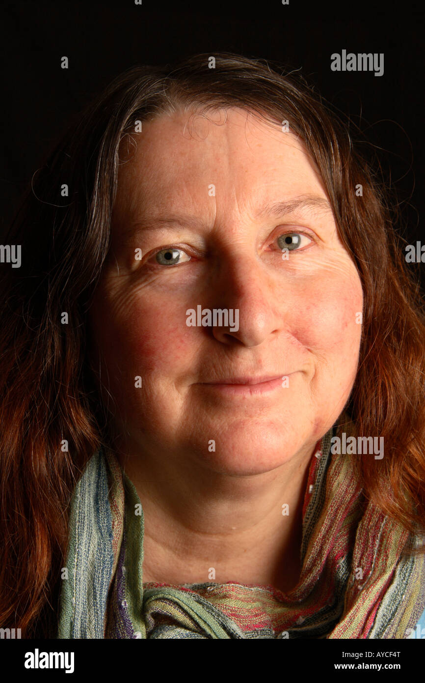 Cosmetic face surgery scars healing after three weeks Stock Photo Alamy