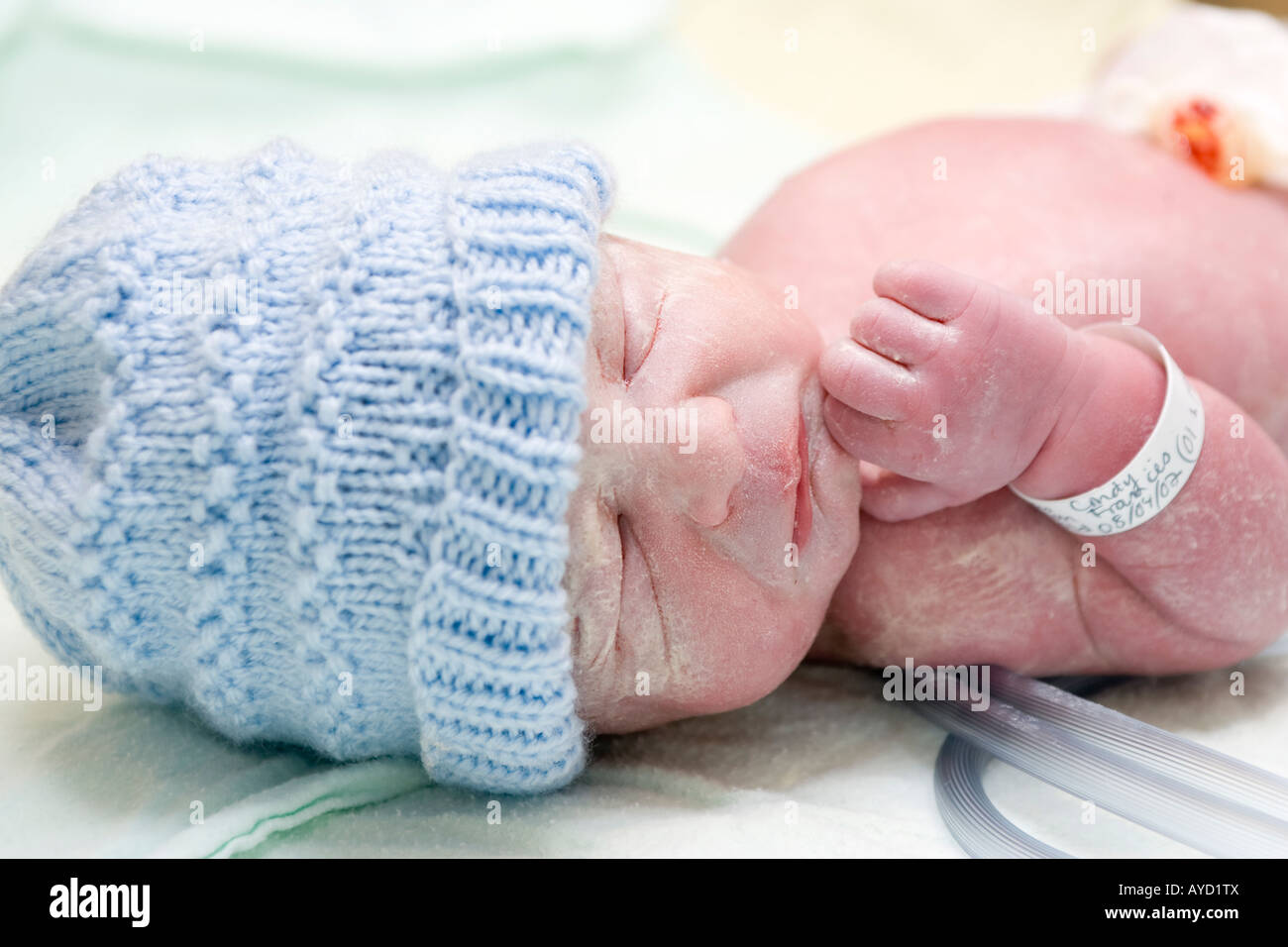 A 5 weeks premature baby seconds after being born Stock Photo