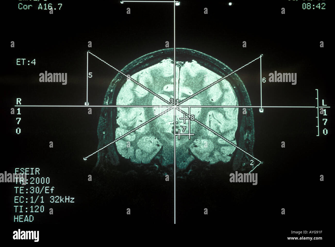 Human brain mri Stock Photo Alamy