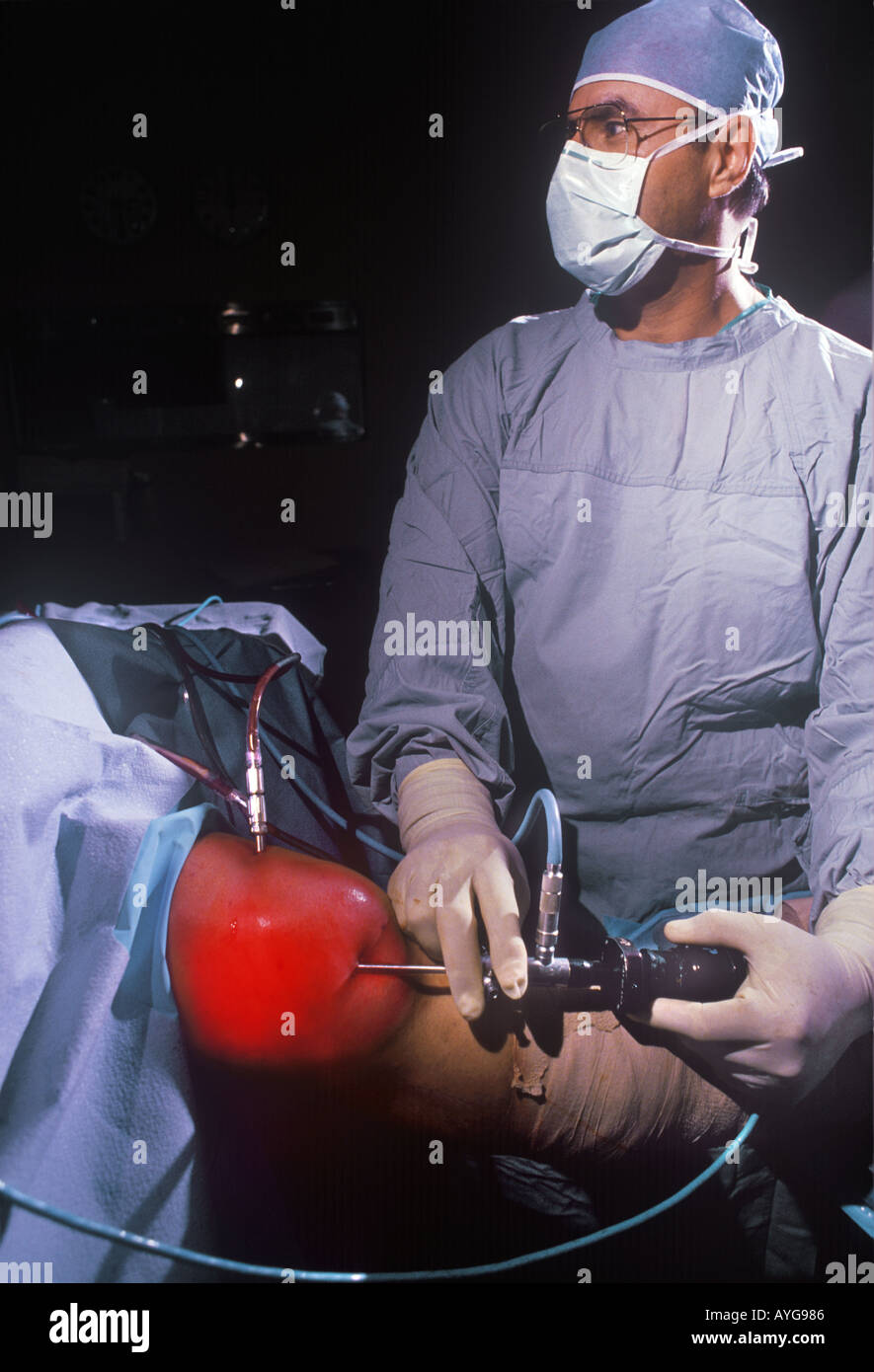 Knee surgery scope hires stock photography and images Alamy
