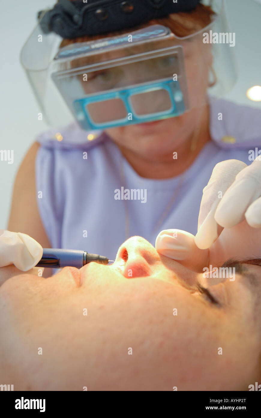 Young Woman receives thread vein removal treatment in a West London Beauty Salon. Stock Photo