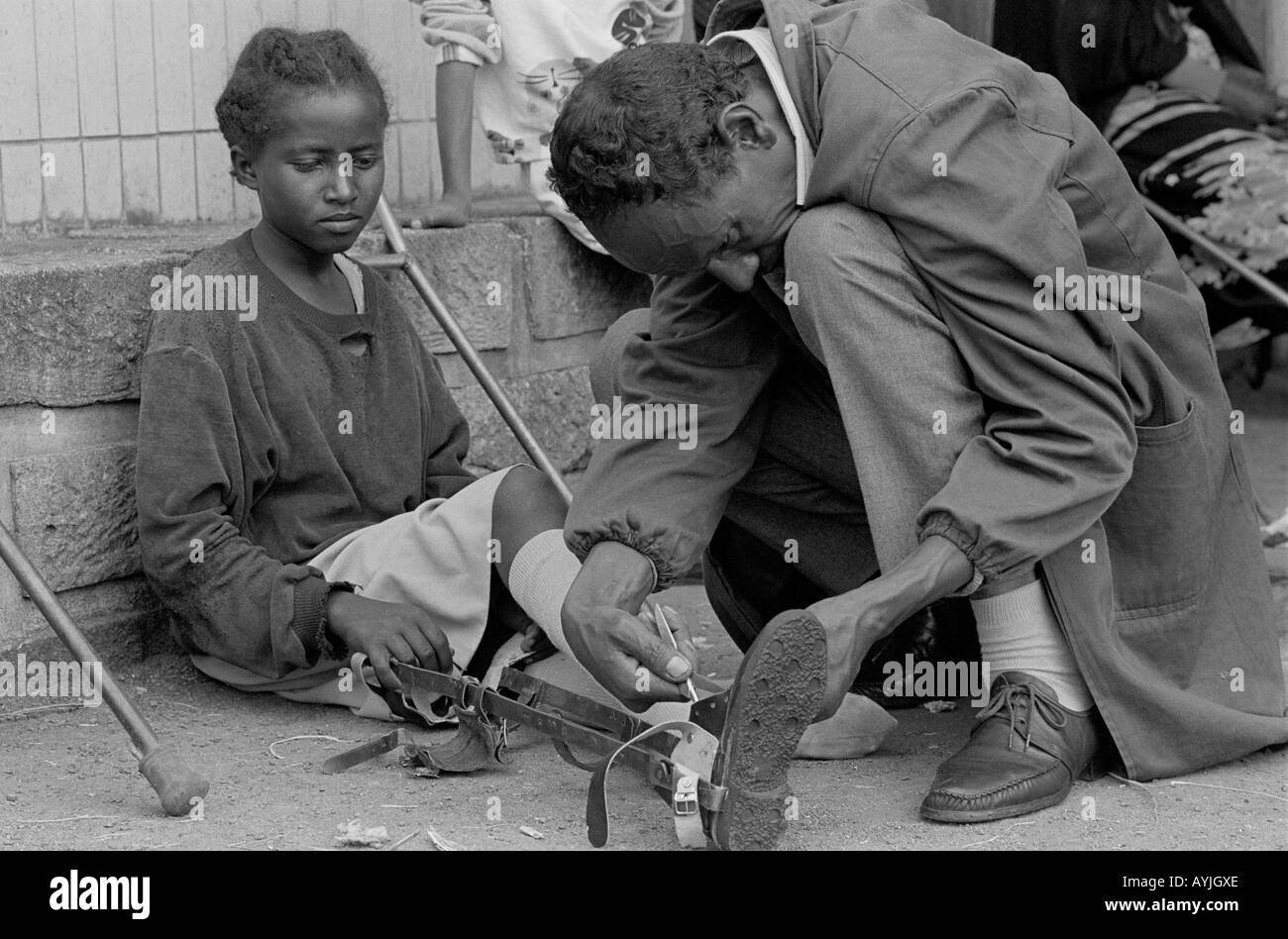 B/W of a mobile technician adjusting the callipers of a girl suffering the effects of polio at Black Lion Hospital. Addis Ababa, Ethiopia Stock Photo
