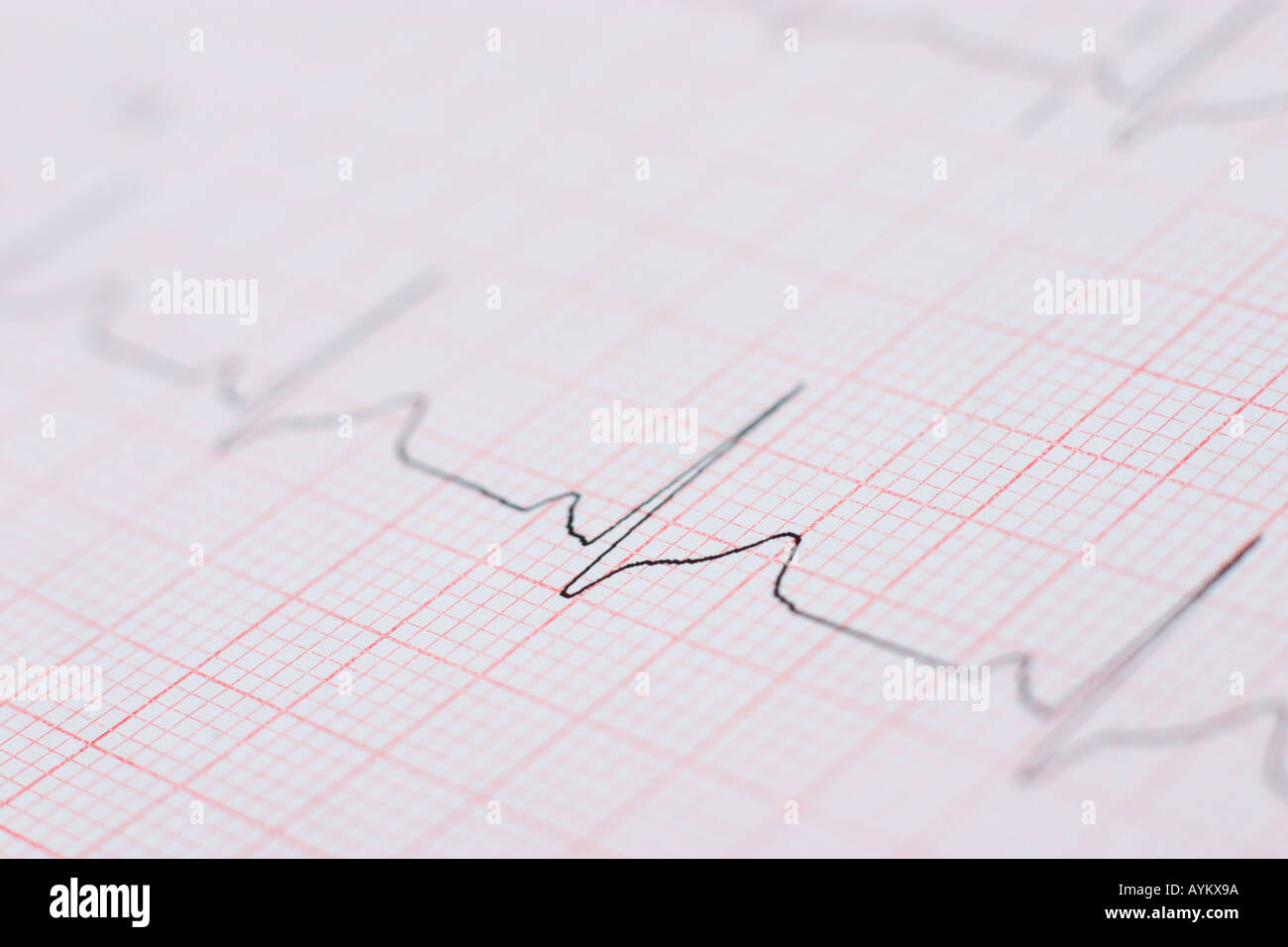 close up of ecg graph electrocardiograph heartbeat pulse Stock Photo