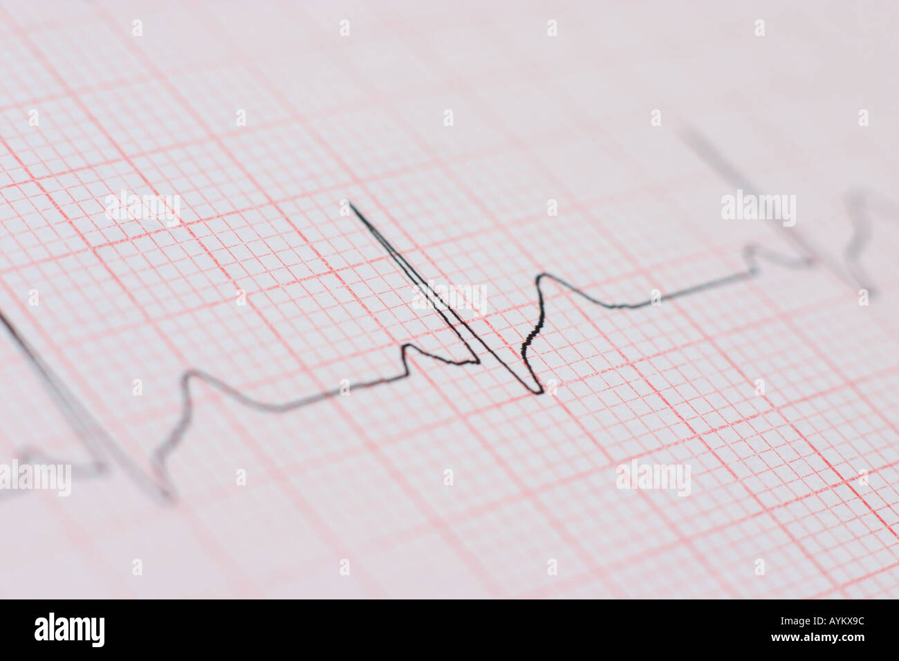 Normal ecg hi-res stock photography and images - Alamy