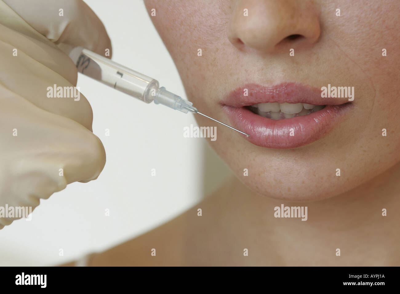 Close up of a woman getting a collagen injection in her lip Stock Photo