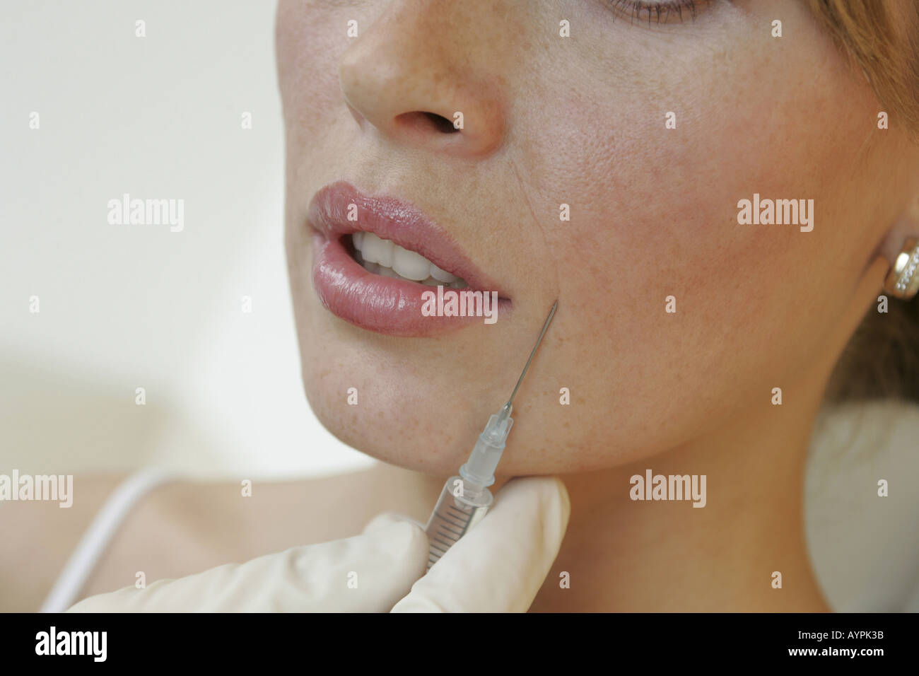 Young woman getting an injection on her face Stock Photo