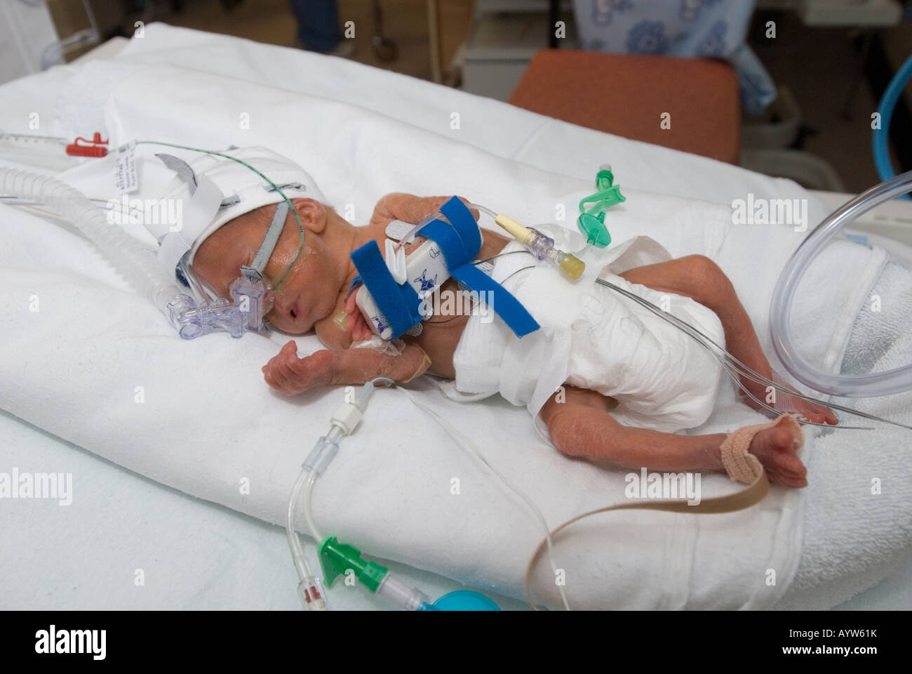 Premature baby sale in incubator