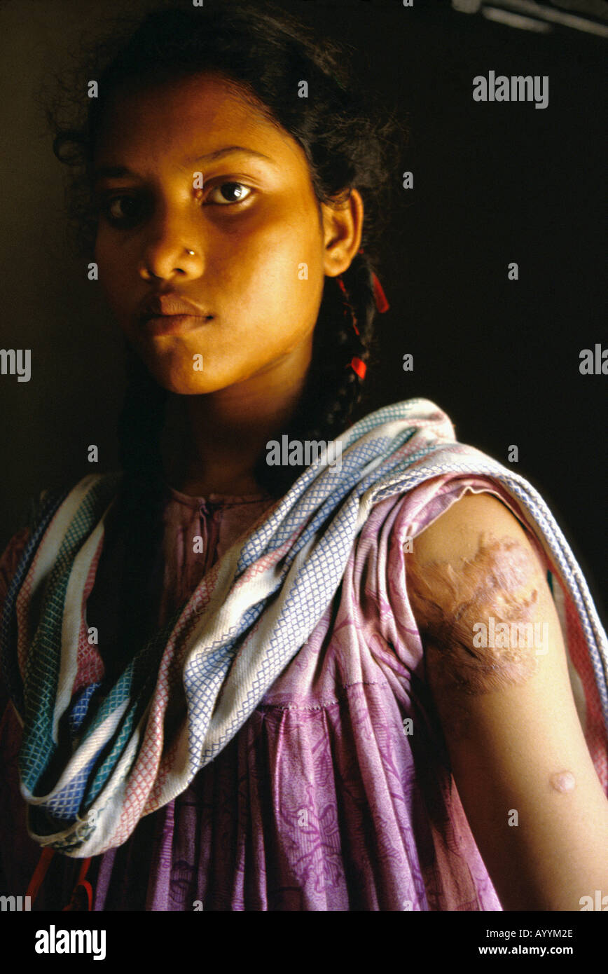 Tort oyoqda turgan qizlar, yaqindan olingan fotosurat Tort oyoqda turgan qizlar, yaqindan olingan fotosurat