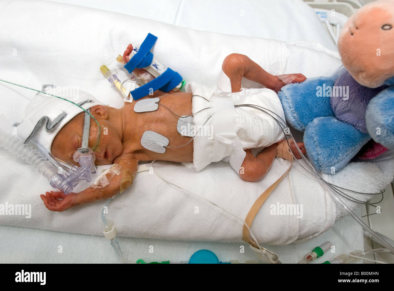 Premature baby in an incubator on a neonatal intensive care unit Stock Photo
