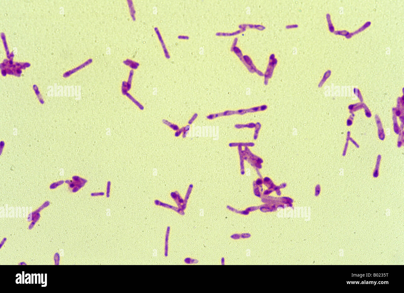 Clostridium botulinum bacteria Stock Photo