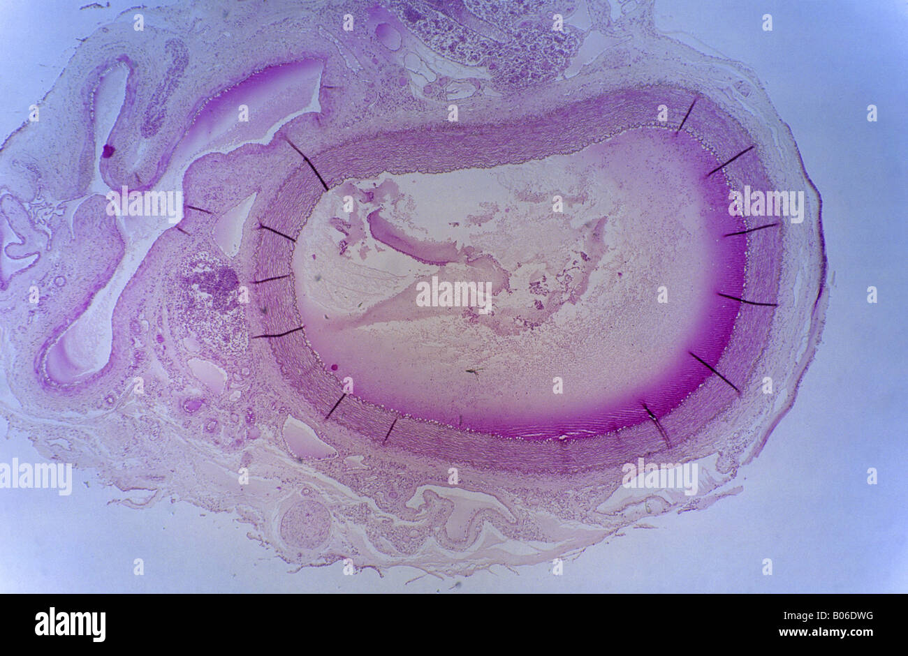 Light Microscope Artery Hi Res Stock Photography And Images Alamy