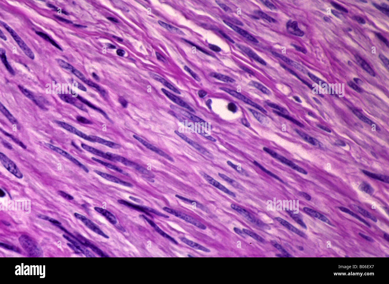 Smooth muscle fibres Stock Photo