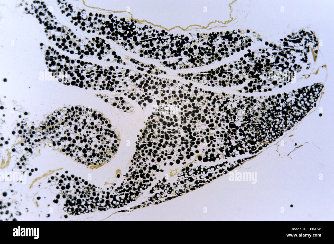 Fat cells Adipose tissue 9x Stock Photo