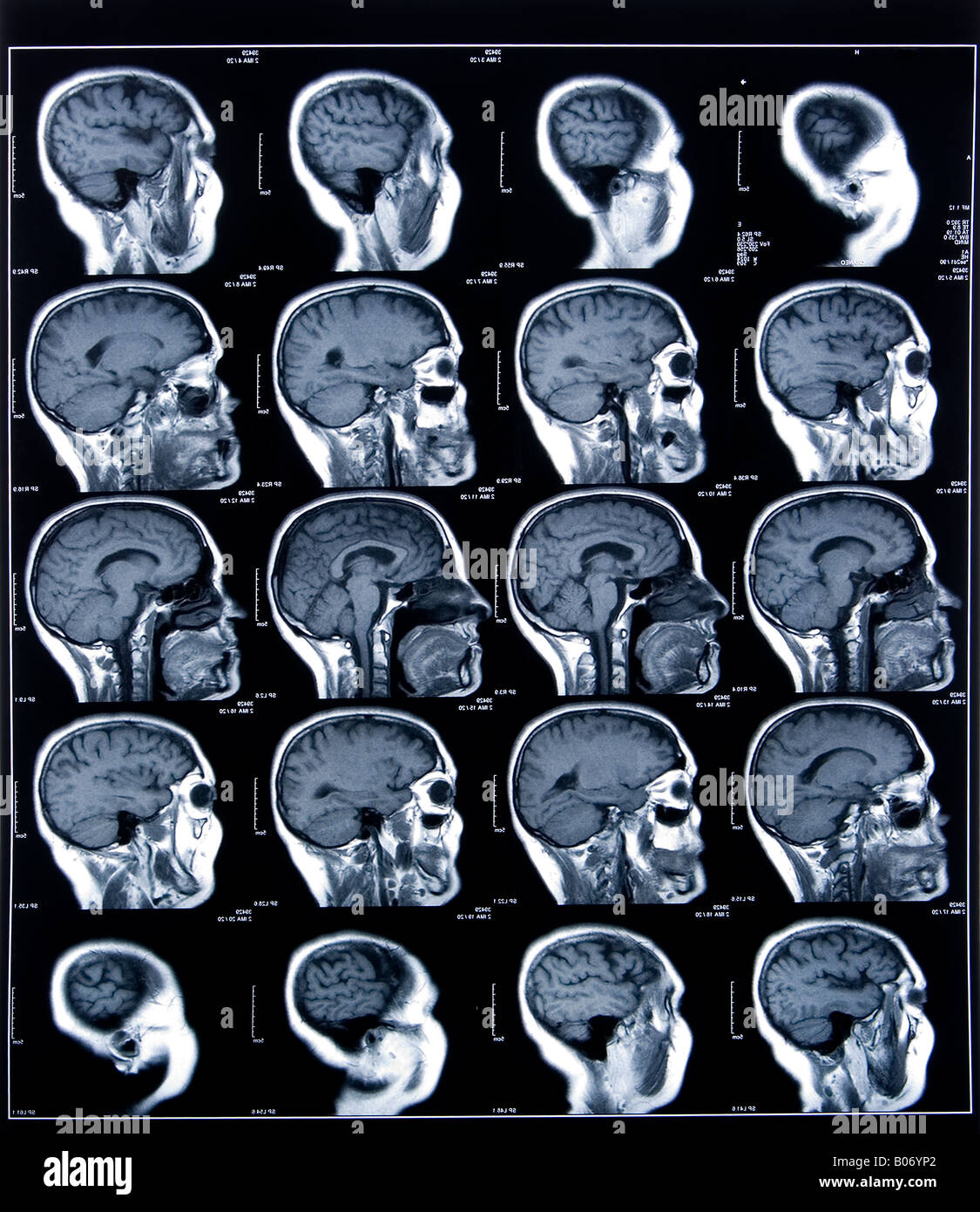 health medical image of an mri of the head showing the brain Stock Photo