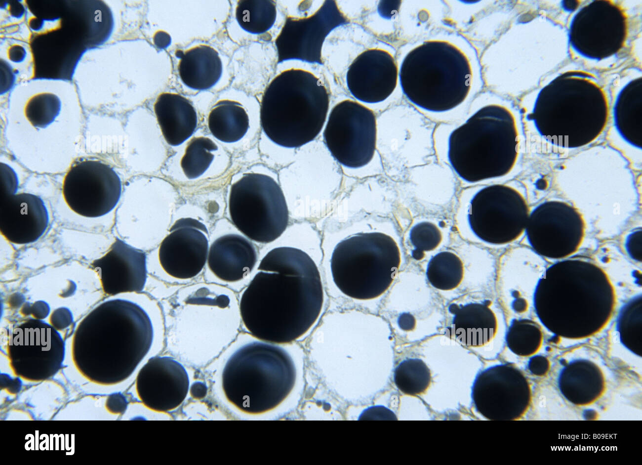 Fat cells Adipose tissue Stock Photo - Alamy