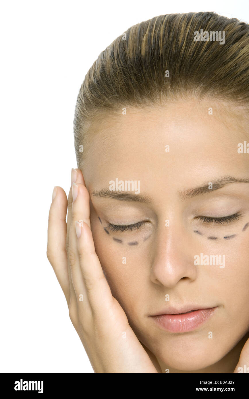 Woman with plastic surgery markings under eyes, holding face, eyes