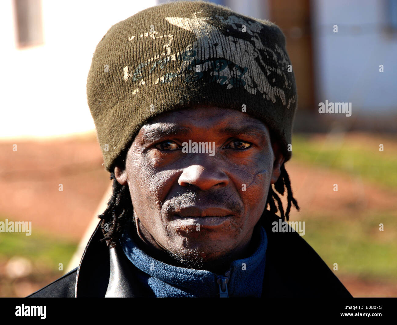 Man with a scar from Zolani Stock Photo