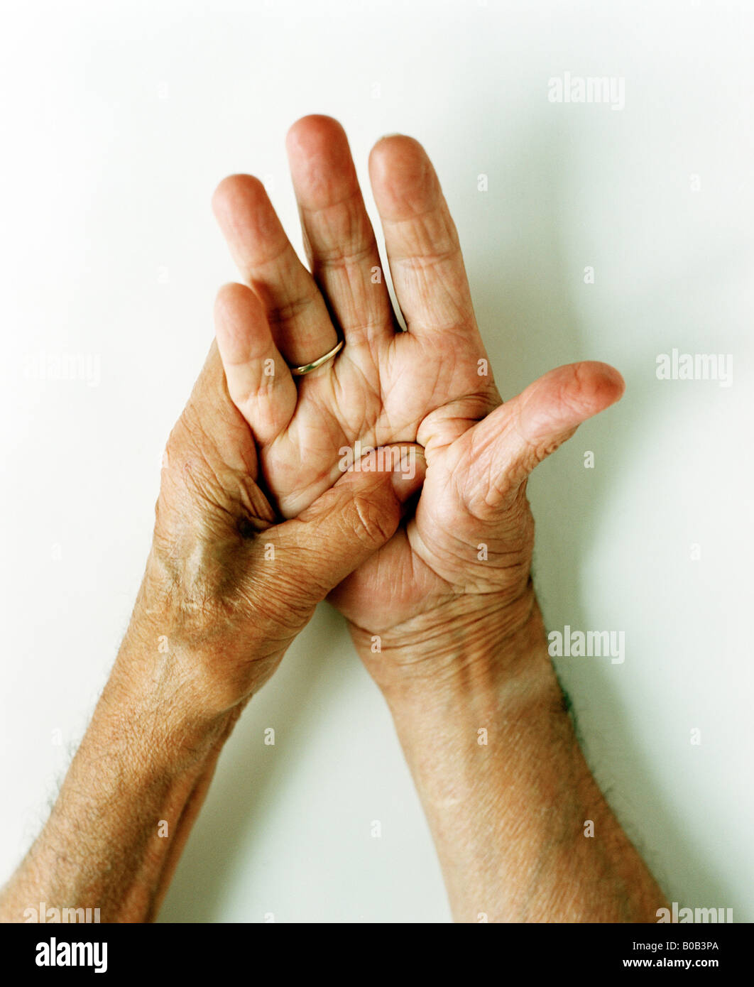 Ointment hand sting hi-res stock photography and images - Alamy