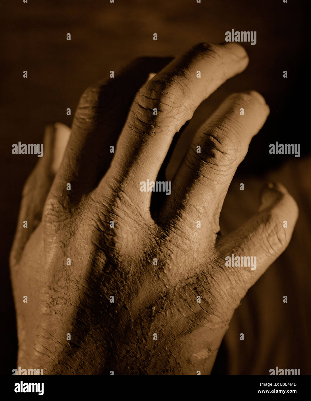 hands with cracked covering on skin Stock Photo